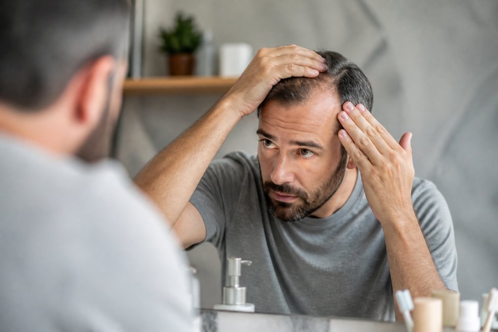 Person examining thinning hair and scalp in a mirror